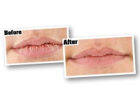 Gorilla® O'Keeffe's Lip Repair Lip Balm
