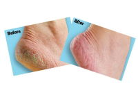 Gorilla® O'Keeffe's Healthy Feet Foot Cream